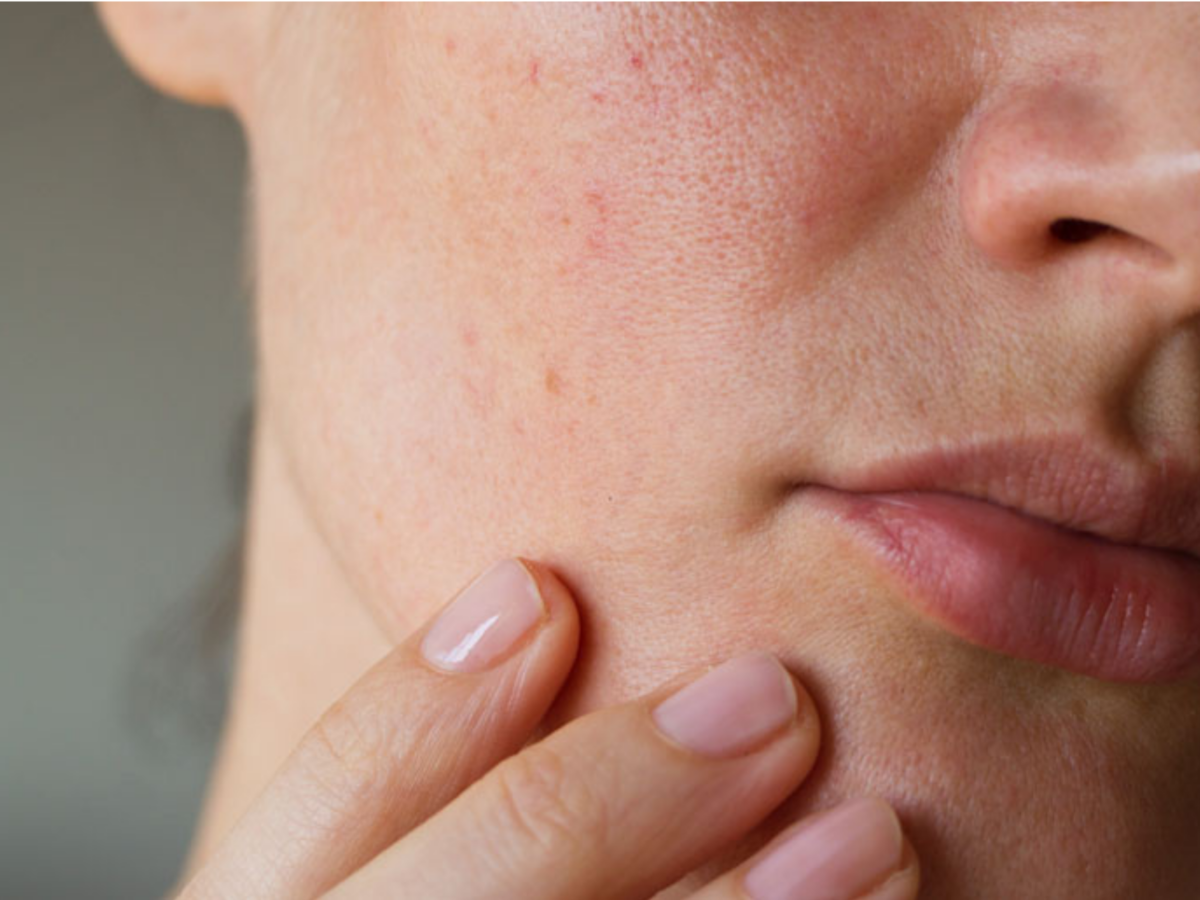 Sociedad Venezolana de Dermatología rechaza contenido de influencers sobre salud y estética de la piel