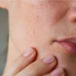 Sociedad Venezolana de Dermatología rechaza contenido de influencers sobre salud y estética de la piel