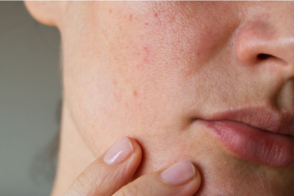 Sociedad Venezolana de Dermatología rechaza contenido de influencers sobre salud y estética de la piel